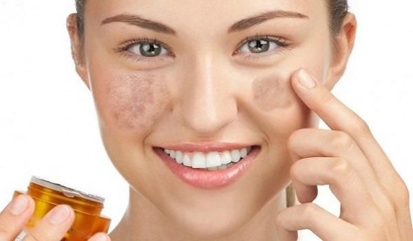 9 dòng mỹ phẩm trị nám được đánh giá và sử dụng được yêu thích rộng rãi 2025