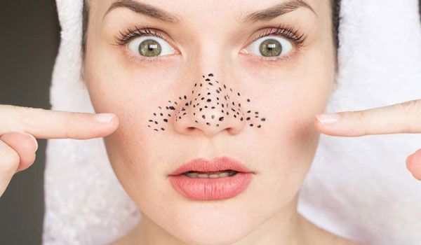 Mụn đầu đen là gì? Top 10 sản phẩm hỗ trợ làm sạch mụn đầu đen se khít lỗ chân lông chất lượng tốt