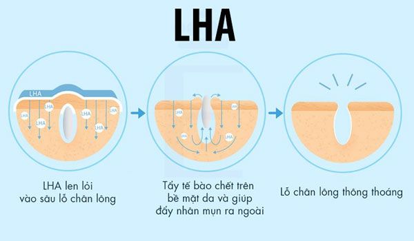 LHA là gì? Công dụng và cách dùng LHA trong làm đẹp