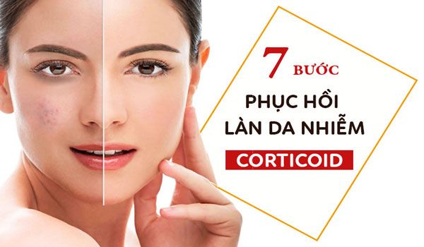 Da bị nhiễm corticoid là gì? 7 cách phục hồi da nhiễm corticoid từ nhẹ đến nặng