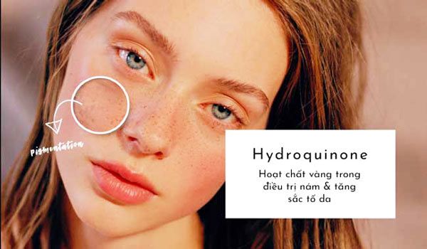 Hydroquinone là gì? Top 5 sản phẩm Hydroquinone trị nám dưỡng trắng da chất lượng tốt