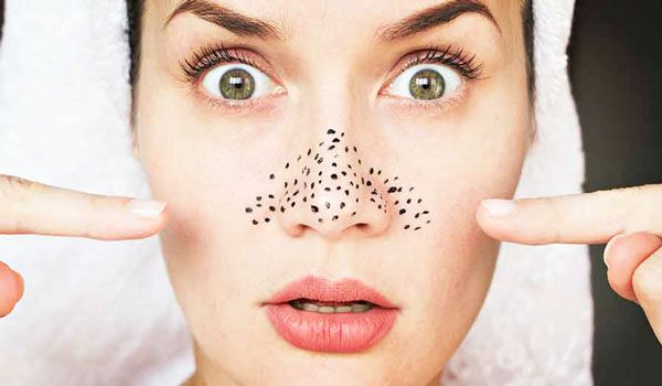 Top 7 kem hỗ trợ làm sạch mụn đầu đen trên mũi hiệu quả cho da sáng mịn