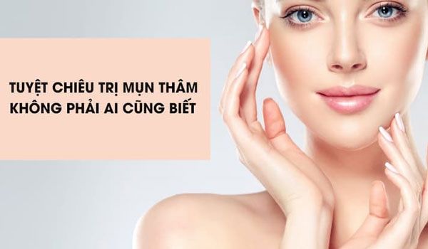Top 11 cách hỗ trợ làm sạch mụn thâm hiệu quả và nhanh chóng ngay tại nhà