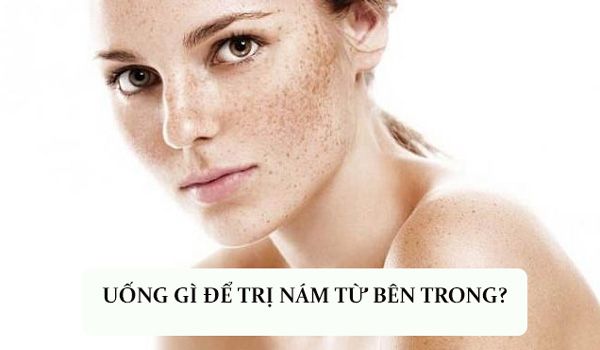 Top 7 đồ uống trị nám từ bên trong hiệu quả hiện nay