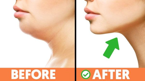 10 bài tập giảm mỡ nọng cằm nhanh chóng trong 1 tháng