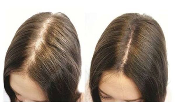 14 cách kích thích tóc mọc dài nhanh trong 1 tuần tại nhà