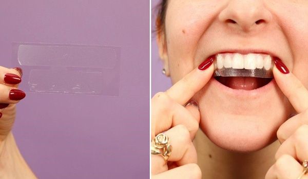 Miếng dán trắng răng có tốt không? Top 5 miếng dán trắng răng bán chạy