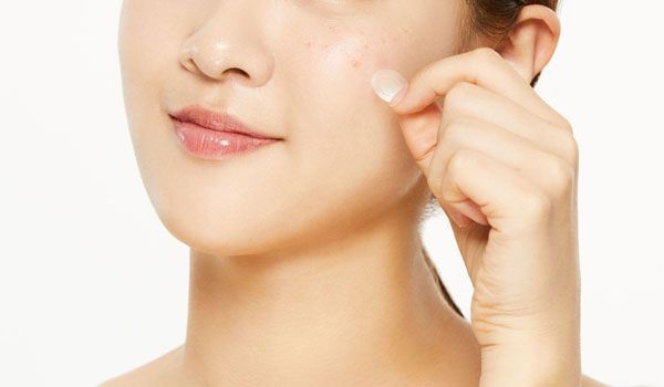 Top 13+ miếng dán hỗ trợ làm sạch mụn chất lượng tốt cho da sạch mụn mịn màng