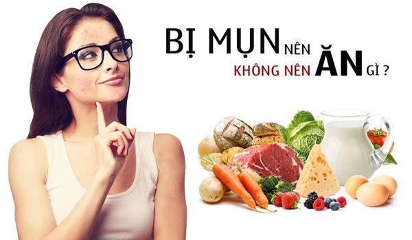Chế độ ăn uống cho da bị mụn: Nên ăn gì và không ăn gì?