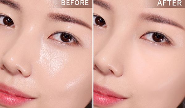 5 cách trị da dầu tại nhà hiệu quả tiết kiệm