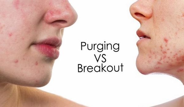 Purging là gì? Tổng hợp những việc cần làm trong quá trình Purging