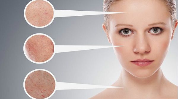Điều hỗ trợ làm sạch mụn ẩn nên dùng AHA hay BHA thì hiệu quả?