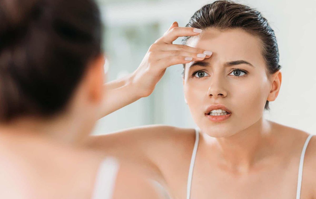 Mụn trên trán: Nguyên nhân và cách hỗ trợ cải thiện hiệu quả từ chuyên gia