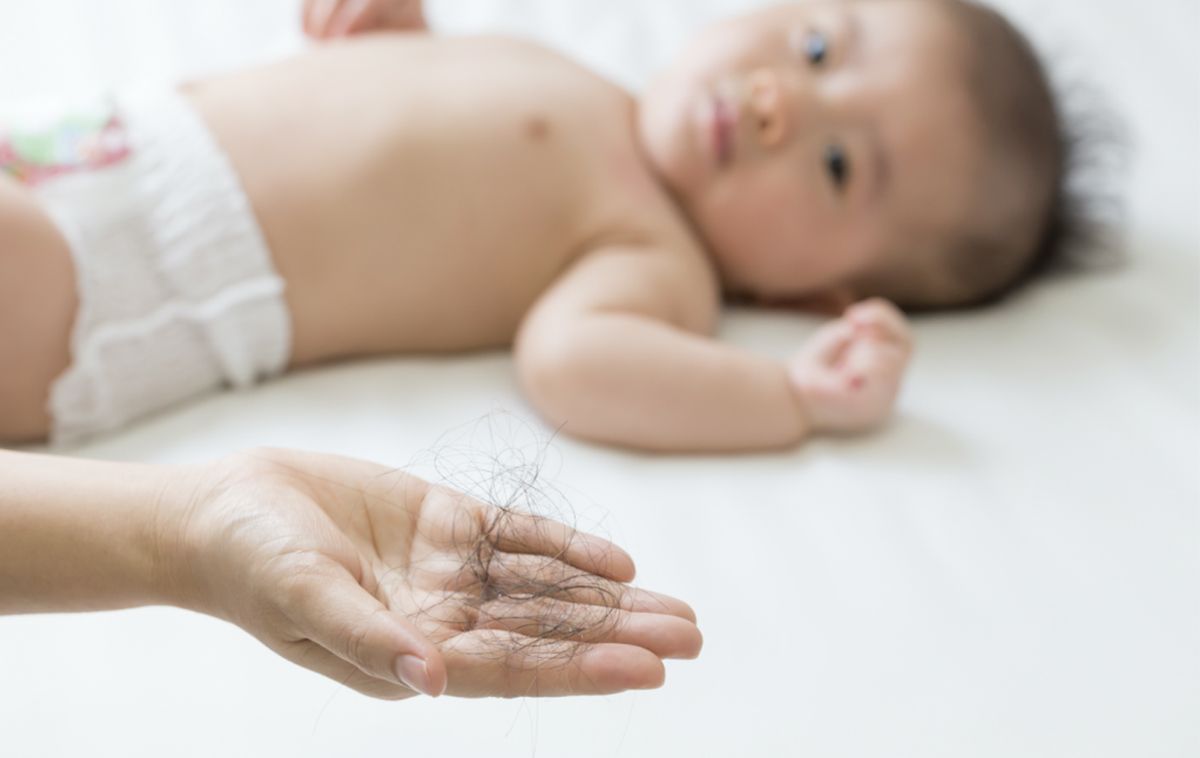 Rụng tóc sau sinh là gì? 13 cách ngăn ngừa tóc rụng cho mẹ bỉm sữa