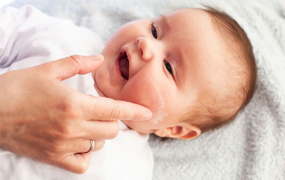 Top 12 kem dưỡng ẩm cho bé bị viêm da cơ địa được nhiều khách hàng yêu thích cho mẹ tham khảo