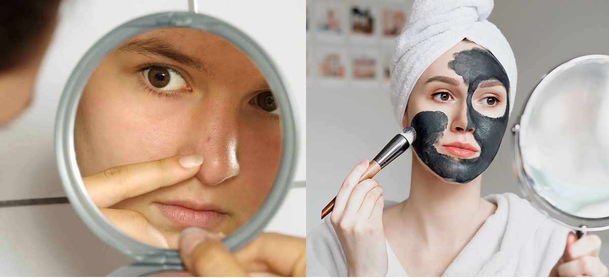 6 sai lầm khi hỗ trợ làm sạch mụn đầu đen mà bạn cần tránh khi chăm sóc da tại nhà