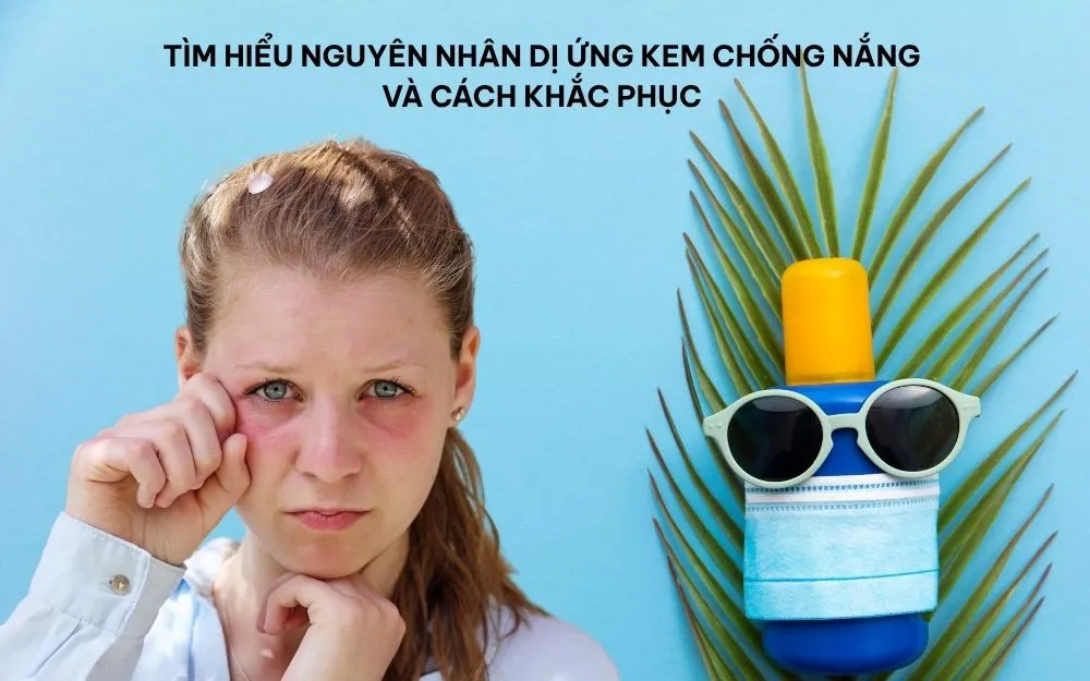 Tìm Hiểu Nguyên Nhân Dị Ứng Kem Chống Nắng & Cách Khắc Phục