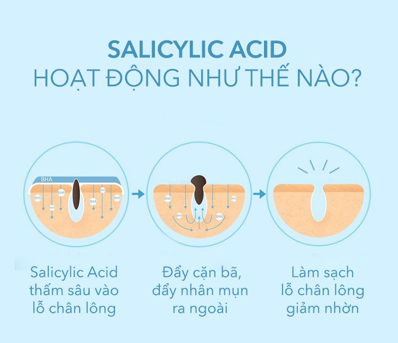 Top 10 loại mỹ phẩm hỗ trợ làm sạch mụn hiệu quả cho làn da khỏe đẹp tự tin mùa Noel - 3