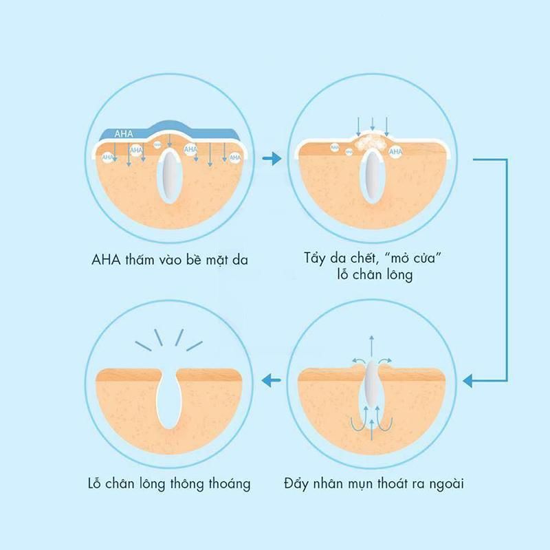 Top 10 loại mỹ phẩm hỗ trợ làm sạch mụn hiệu quả cho làn da khỏe đẹp tự tin mùa Noel - 4