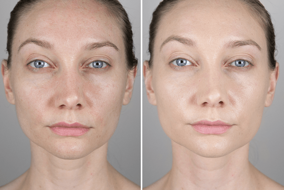 Đánh giá chi tiết tẩy da chết Paula’s Choice Calm Redness Relief 1% BHA Lotion Exfoliant - 6