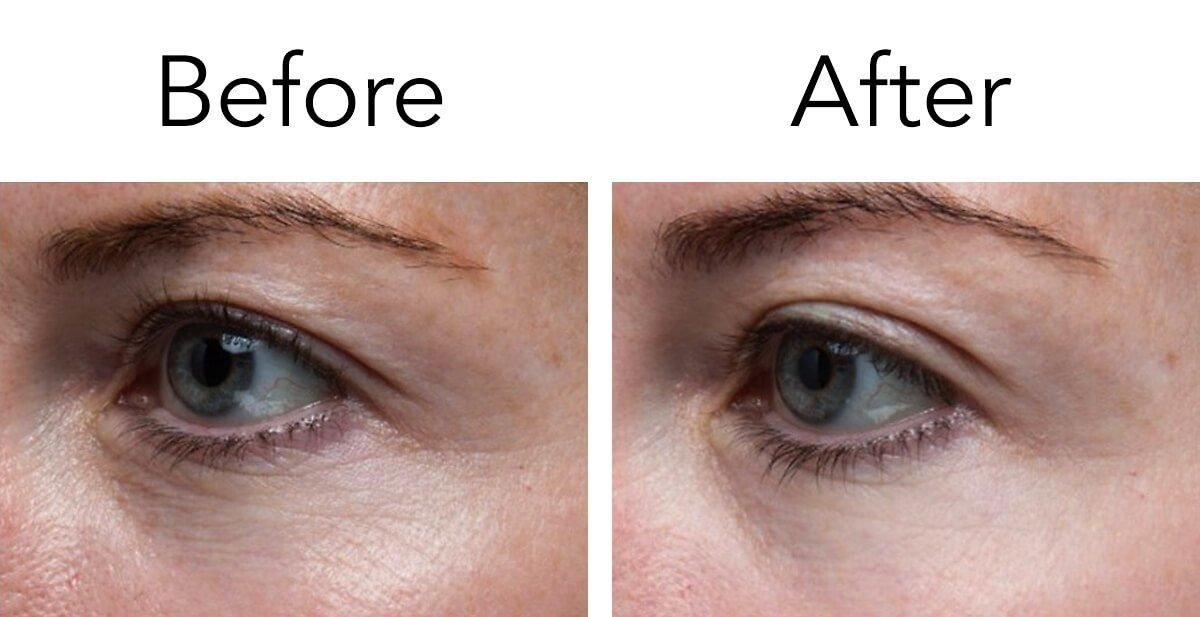 Đánh giá hiệu quả của tinh chất Paula's Choice Clinical 1% Retinol Treatment - 8