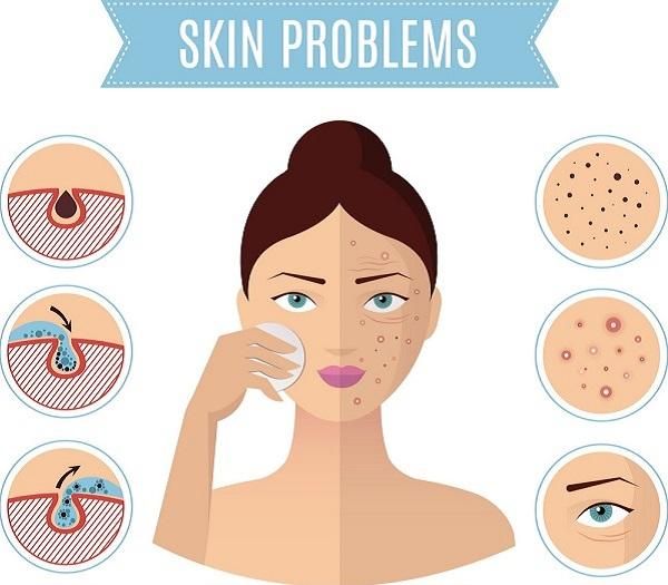 Top 7+ sữa rửa mặt hỗ trợ làm sạch mụn cho da dầu được nhiều khách hàng yêu thích làm sạch hiệu quả và thân thiện với làn da - 19