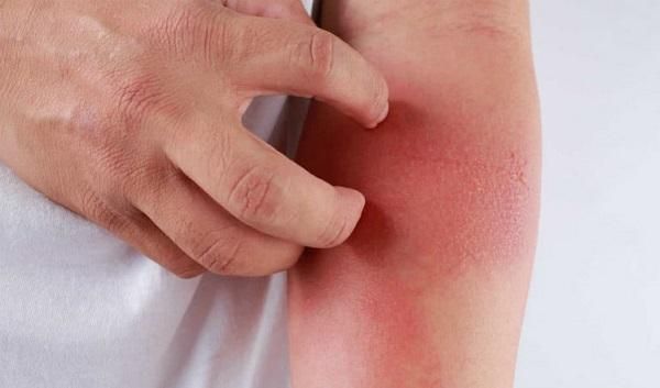 Nên sử dụng máy triệt lông cao cấp tại nhà hay triệt lông tại spa thẩm mỹ - 9