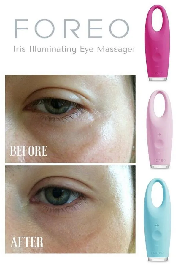 Review chi tiết máy massage mắt Foreo Iris xóa tan vết nhăn và bọng mắt