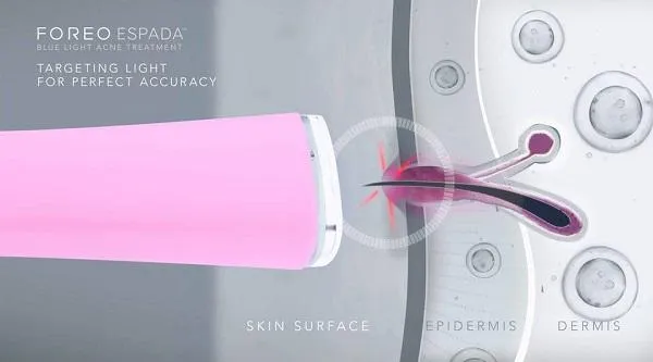 Review máy hỗ trợ làm sạch mụn bằng ánh sáng xanh FOREO Espada ngay tại nhà