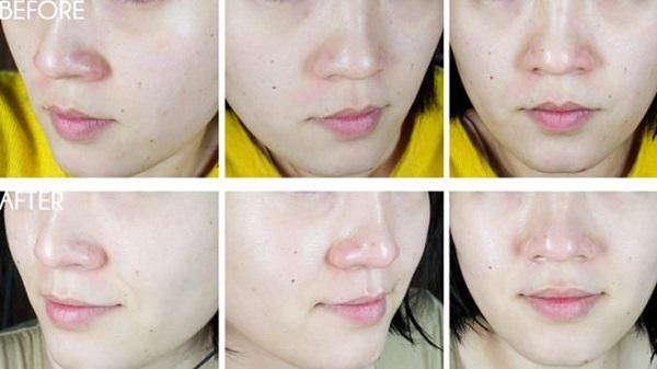 Review top 5 sản phẩm Paula's Choice hỗ trợ làm sạch mụn hiệu quả cho mọi loại da