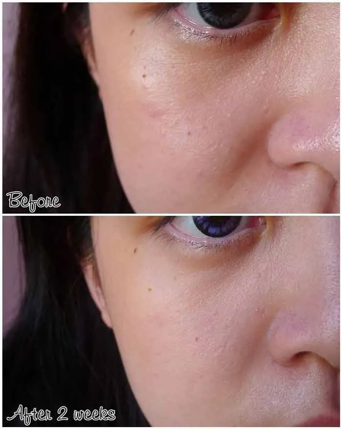 Mua mỹ phẩm Lancome chính hãng ở đâu giá tốt uy tín? - 7