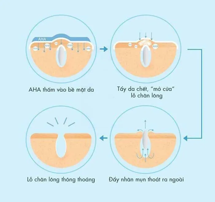 AHA là gì? Top 5 mỹ phẩm dưỡng da chứa AHA được nhiều khách hàng yêu thích đáng mua