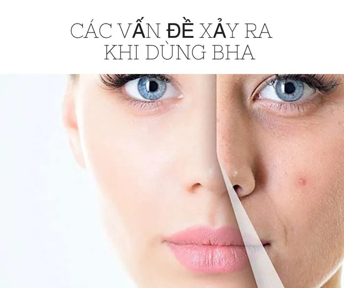 BHA là gì? Công dụng và cách dùng mỹ phẩm BHA hiệu quả