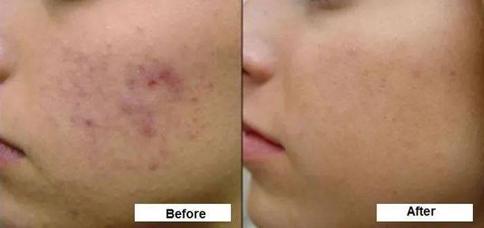 Review mỹ phẩm Neutrogena có tốt không? Top 5 sản phẩm đáng mua - 7