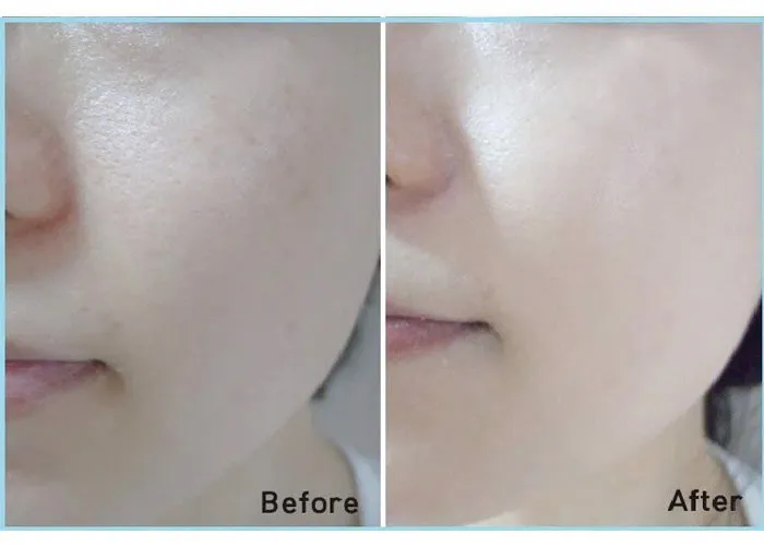 Mỹ phẩm SK-II có tốt không? Các sản phẩm SK-II được yêu rất thích