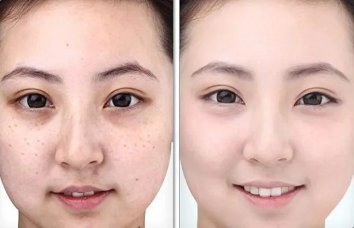 Review kem dưỡng làm mờ nám Transino công dụng thành phần cách dùng giá bán - 6