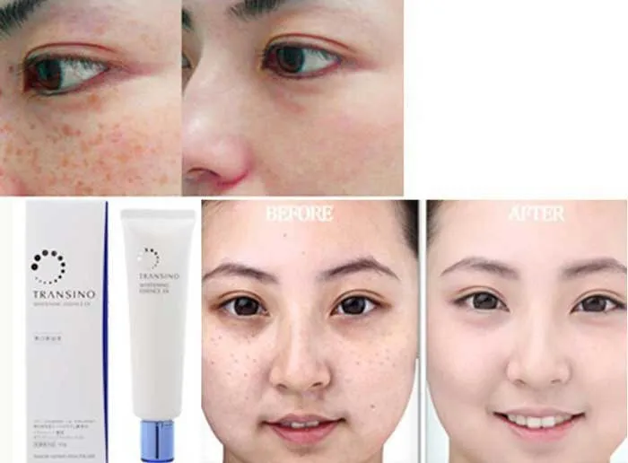 Review top 5 mỹ phẩm Transino trị nám của Nhật được nhiều khách hàng yêu thích hiện nay