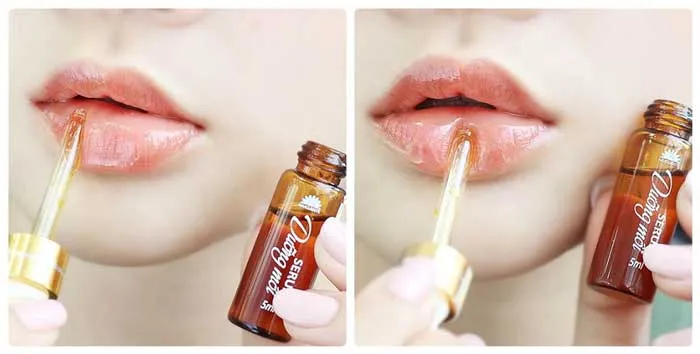 Top 15 loại son dưỡng môi hỗ trợ trị thâm chất lượng tốt nên dùng
