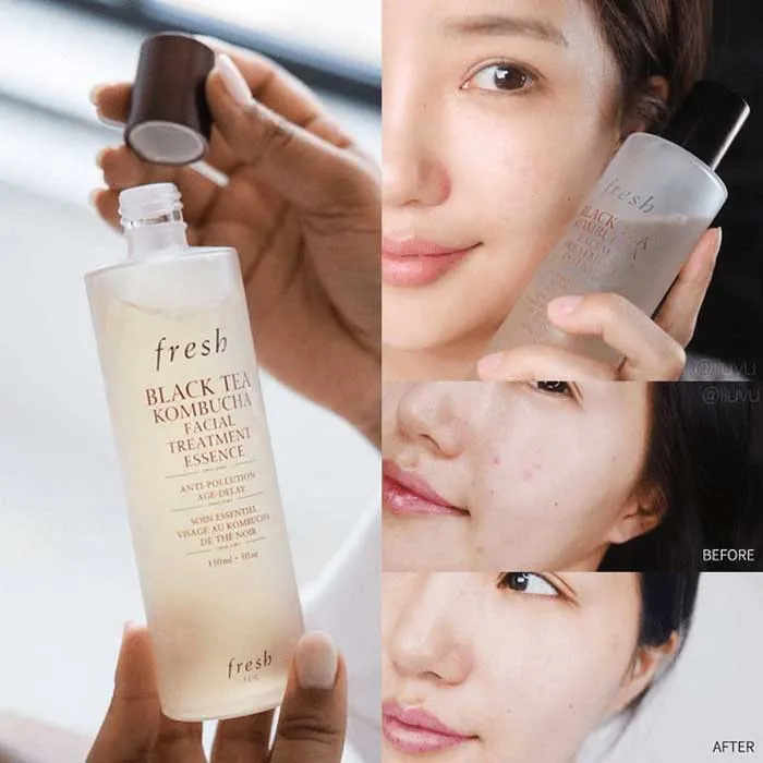 Nước thần là gì? Top 5 chai nước thần làm đẹp da nổi tiếng - 8