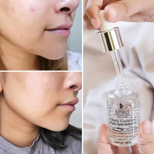 Serum là gì? Có những loại serum dưỡng da nào? Công dụng và cách dùng