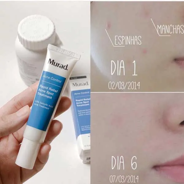 Review top 12 mỹ phẩm Murad hỗ trợ hỗ trợ cải thiện và dưỡng da chất lượng tốt