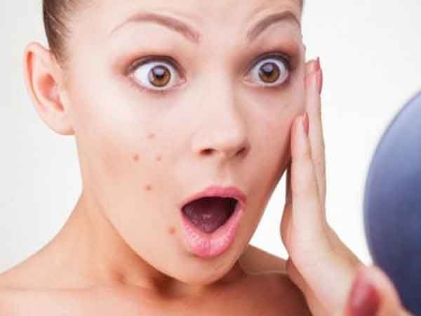 Nguyên tắc chăm sóc da mụn tại nhà thân thiện với làn da, hiệu quả sau 1 tuần
