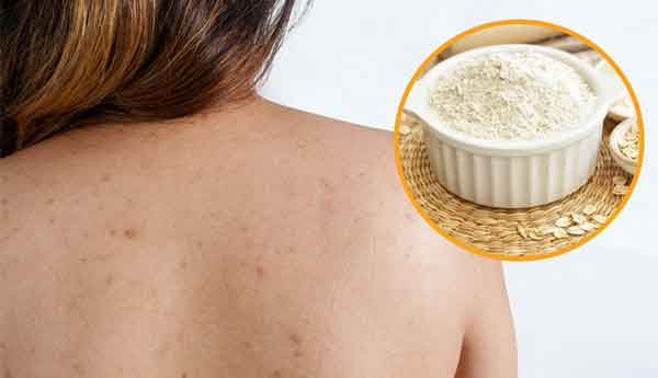 Review 8 sữa tắm hỗ trợ làm sạch mụn lưng cho nữ giá rẻ được tin dùng nhiều