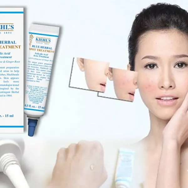 Mụn ẩn là gì? Review 7 sản phẩm hỗ trợ làm sạch mụn ẩn tại nhà rất triệt để