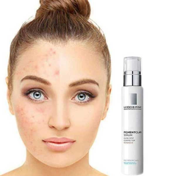 Mỹ phẩm La Roche Posay có tốt không? Review chi tiết 8 sản phẩm chất lượng tốt