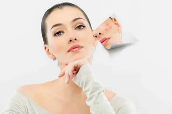 Cách rửa mặt đúng cho da mụn- Review 7 sữa rửa mặt mùa hè cho da dầu được nhiều khách hàng yêu thích