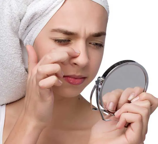 Mụn đầu đen là gì? Top 10 sản phẩm hỗ trợ làm sạch mụn đầu đen se khít lỗ chân lông chất lượng tốt