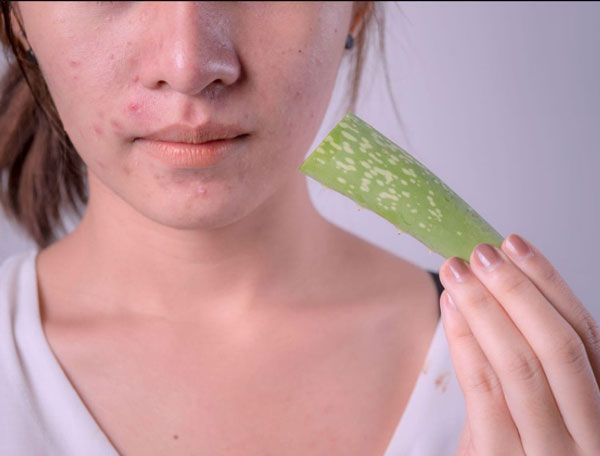 Top 15 mặt nạ trị thâm mụn tại nhà hiệu quả tốc độ vượt trội không thể bỏ qua