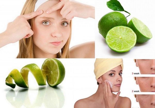 Top 15 mặt nạ trị thâm mụn tại nhà hiệu quả tốc độ vượt trội không thể bỏ qua