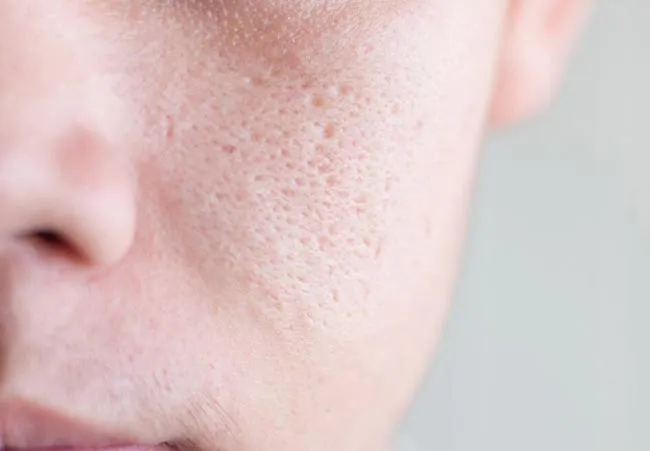 Review 12 loại serum se khít lỗ chân lông chất lượng tốt cho da mịn màng - 1